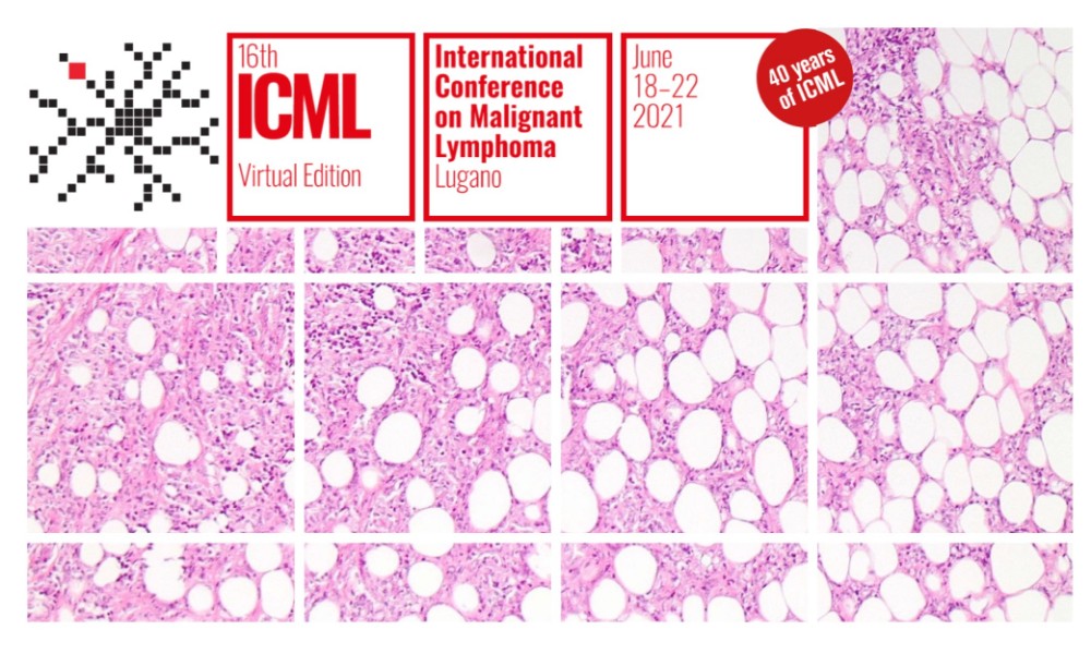 HARMONY participates in the International Conference on Malignant Lymphoma