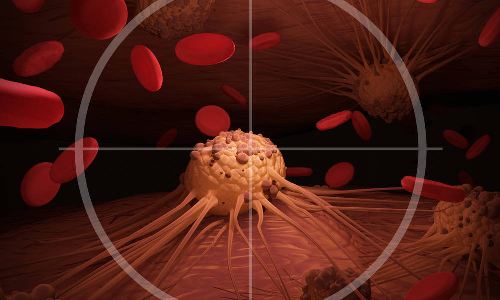 Meanwhile in the USA: a $215-million infusion to support immunotherapy work